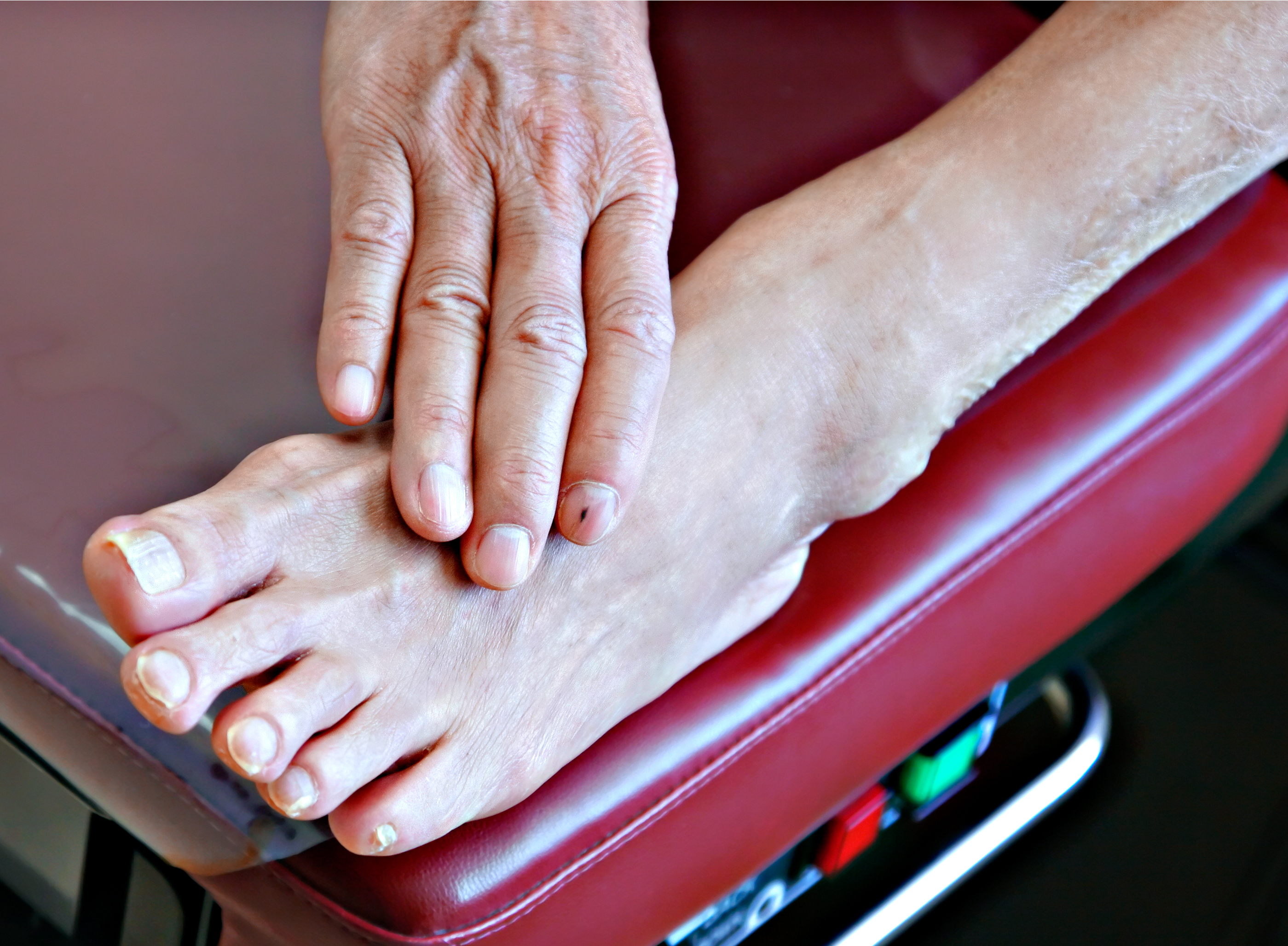 Diabetic braces lafayette foot on examination bench