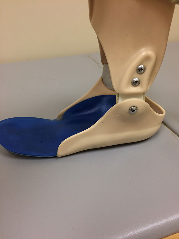 orthotic-lafayette-leg-brace